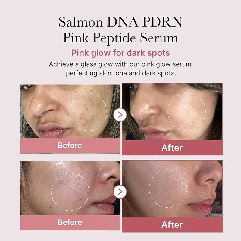 Salmon DNA PDRN Pink Peptide Serum for Skin Repair & Firming - Korean Skincare