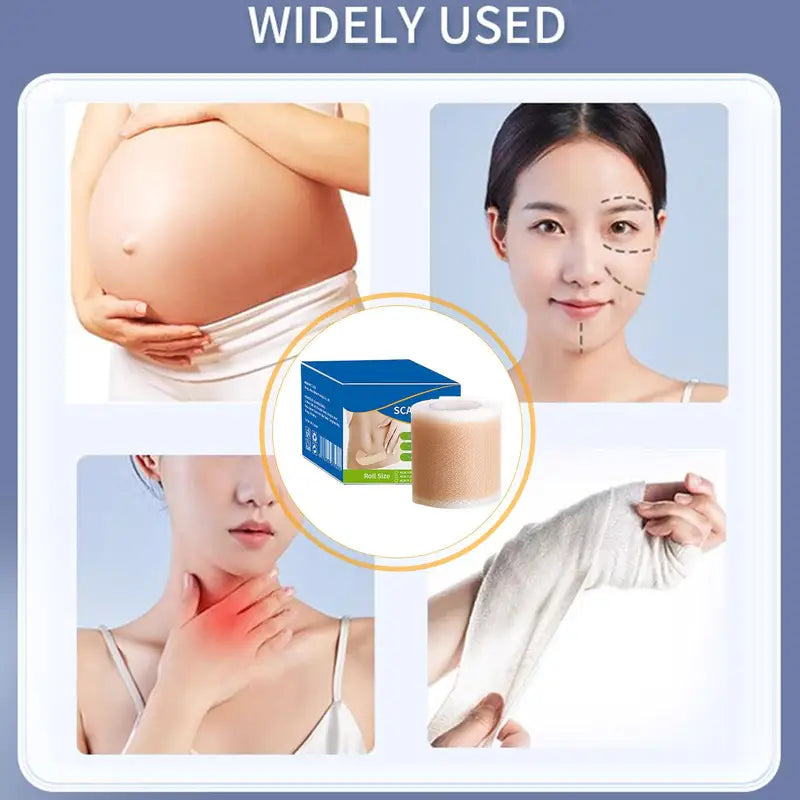 Silicone Scar Removal Strips - Reusable Skin Healing Tape for Surgery Burn Acne