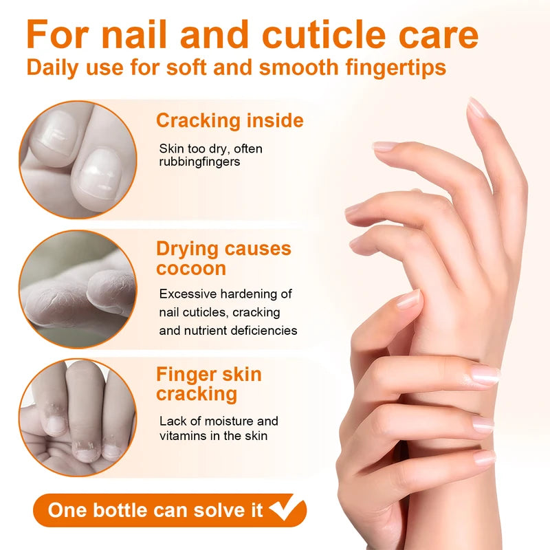 Honey Milk Cuticle Oil - 30ml Nail & Cuticle Moisturizer for Dry & Thin Nails