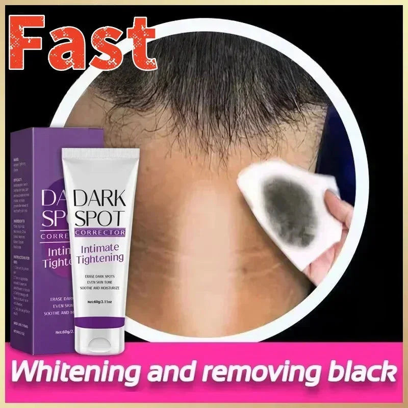 Body Whitening Cream for Dark Skin - Melanin Removal & Brightening Lotion