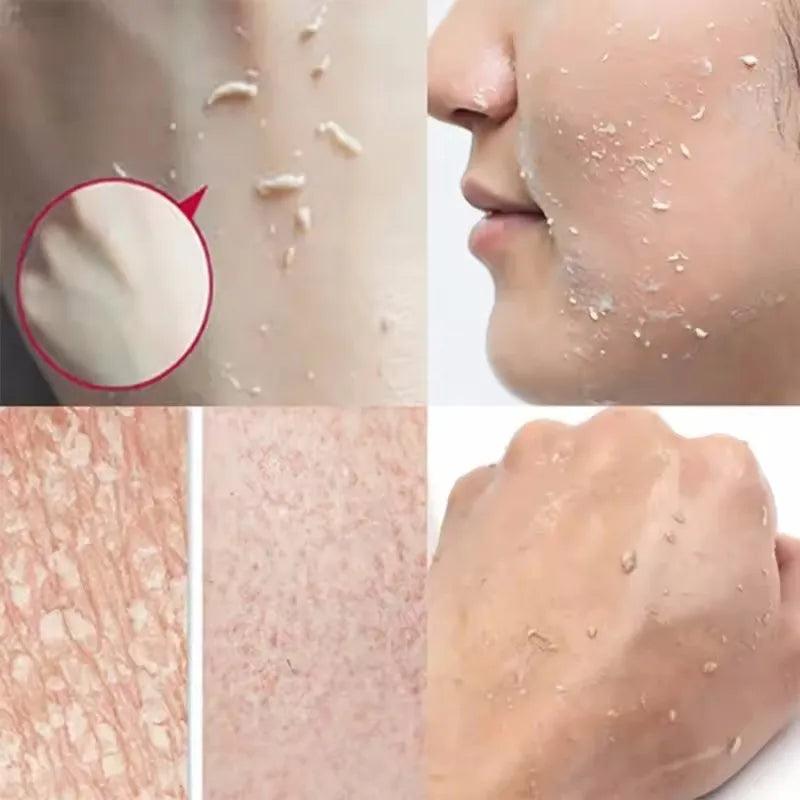 Exfoliating Peeling Gel Facial Scrub for Moisturizing & Blackhead Removal