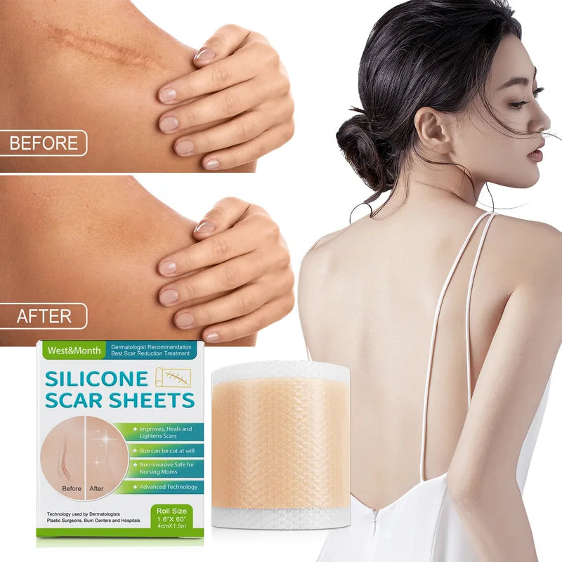 Invisible Silicone Scar Sheets Roll 2.5cm x 450cm Self-Adhesive Skin Cover Tape
