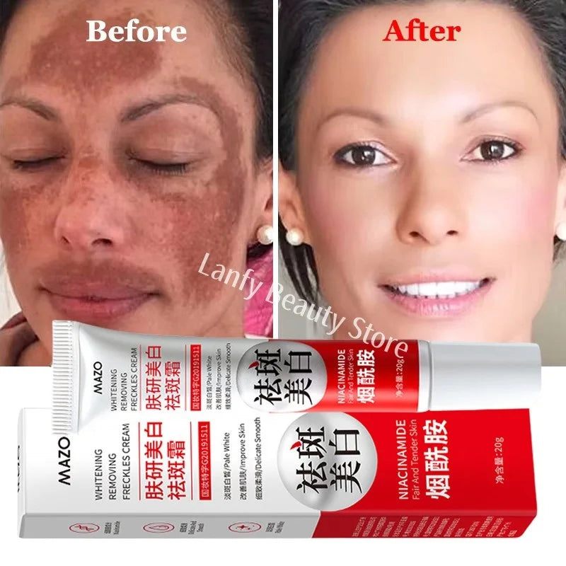 Powerful Skin Brightening Cream for Melasma Dark Spots & Pigmentation Removal - Korean Skin Care
