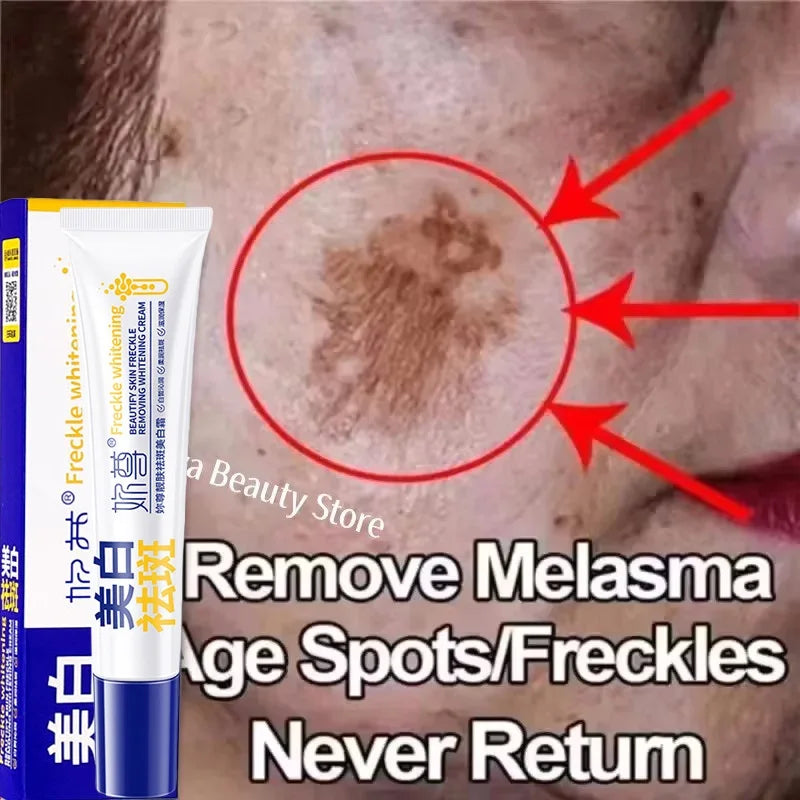 Brightening Spot-Removing Skin Cream for Melasma Dark Spots & Pigmentation - All Colors