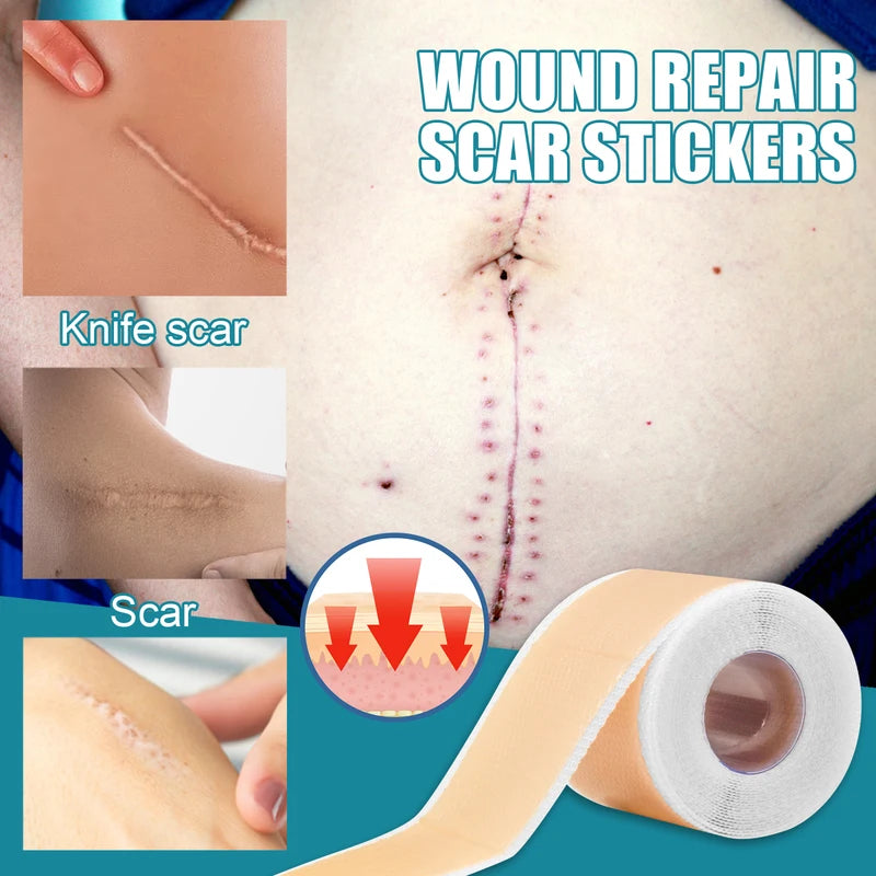 Reusable Silicone Scar Sheets for Surgical & Hypertrophic Scars - Medical Grade, Custom Fit
