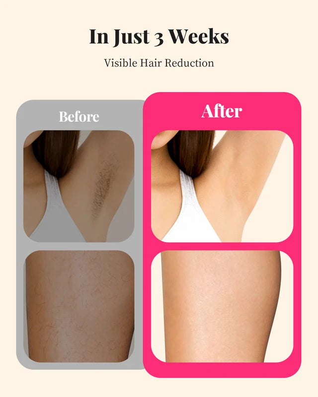 IPL Hair Removal Device for Women & Men Painless Permanent Body & Facial Treatment