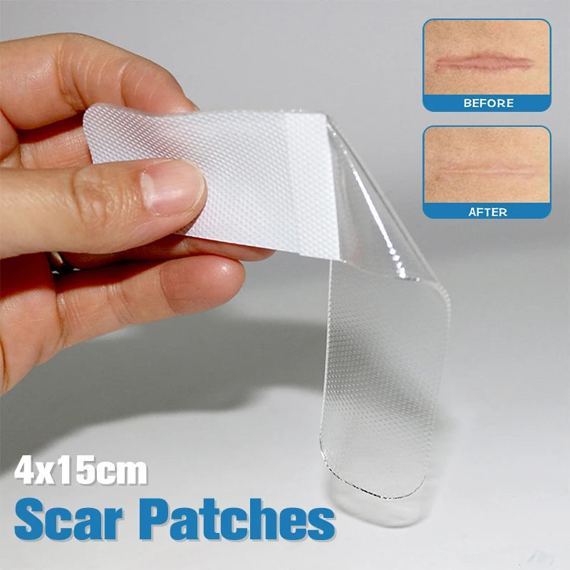 Silicone Scar Removal Patches - 4 Pack 15cm Wound & Burn Scar Tape