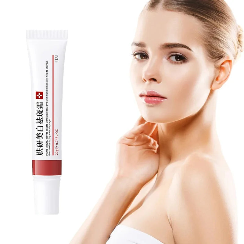 Freckle Cream for Face Brightening & Dark Spot Removal - 20g