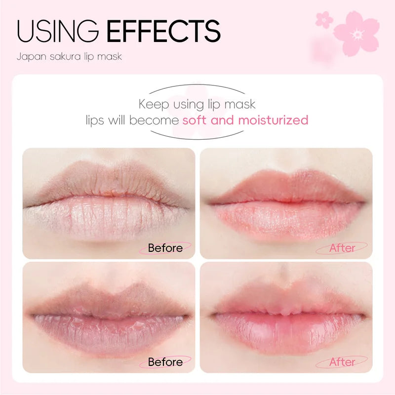 Moisturizing Lip Mask Set - Hydrating Repair Lip Care Patches for Smooth Lips