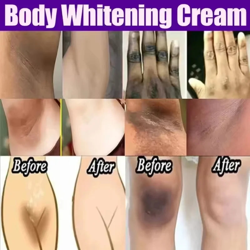 Whitening Cream for Private Parts & Body - Brighten Dark Areas & Remove Melanin