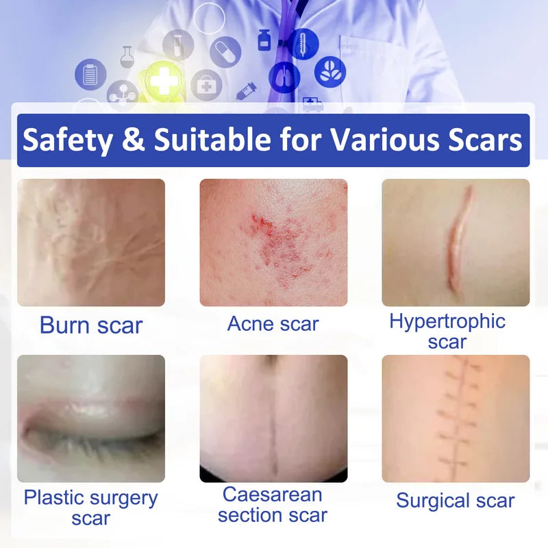 Reusable Silicone Scar Sheets Self-Adhesive Skin Care Tape 4cm x 300cm