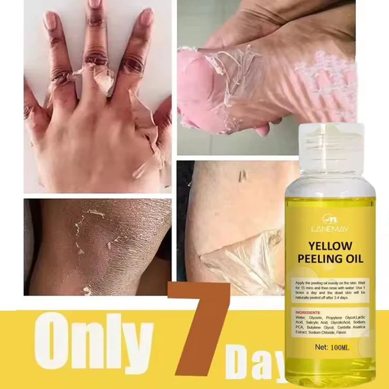 Yellow Peeling Oil for Skin Lightening and Exfoliation - Body & Face