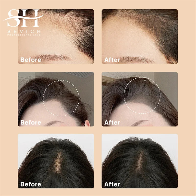 Hairline Concealer Powder for Thinning Hair & Gray Cover - Natural Finish