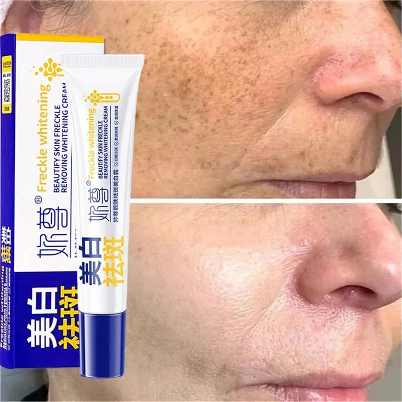 Whitening Face Cream for Dark Spots & Melasma - Brightening Skin Fast