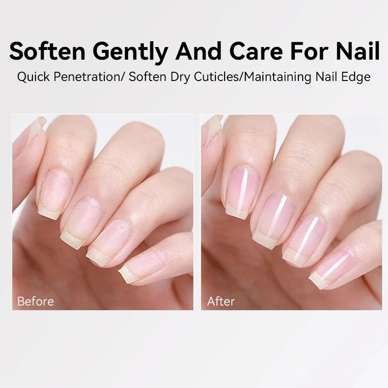 15ml Nail Cuticle Softener Oil for Dead Skin Removal & Nail Care