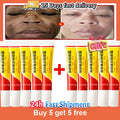 Whitening Freckle Cream for Face Brightening & Melasma Reduction - Niacinamide Skin Care