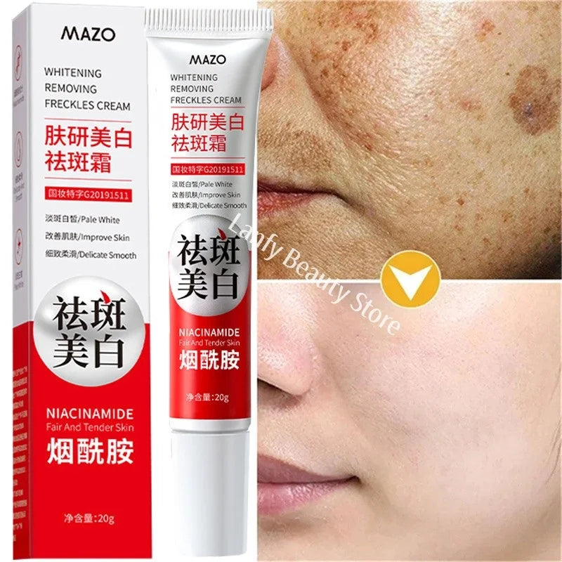 Powerful Skin Brightening Cream for Melasma Dark Spots & Pigmentation Removal - Korean Skin Care