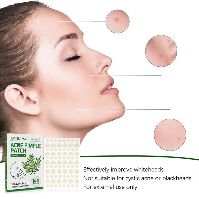 Acne Patches 144pcs Translucent Hydrocolloid Salicylic Tea Tree Oil for Inflamed Skin