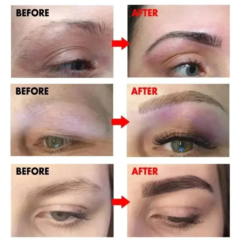 Eyebrow & Eyelash Growth Serum - Hair Loss Prevention & Fuller, Thicker Lengthening 30ml