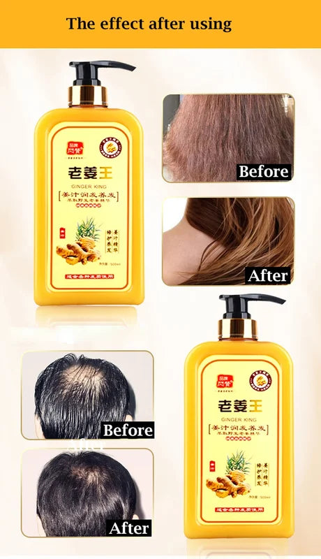 Ginger Hair Loss Shampoo for Damaged Dry Oily Scalp Repair & Growth