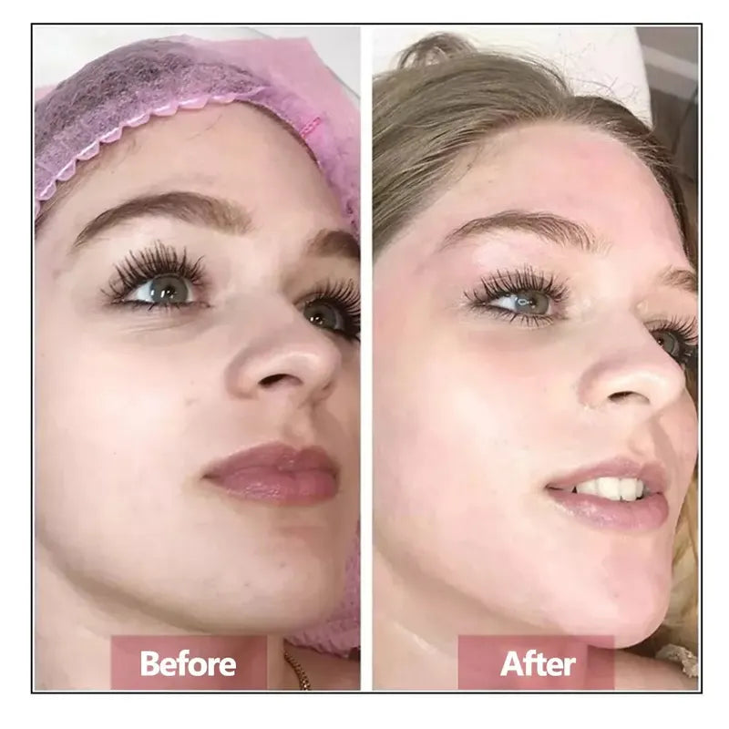 Hyaluronic Acid Face Serum for Skin Rejuvenation & Hydration - 50ml
