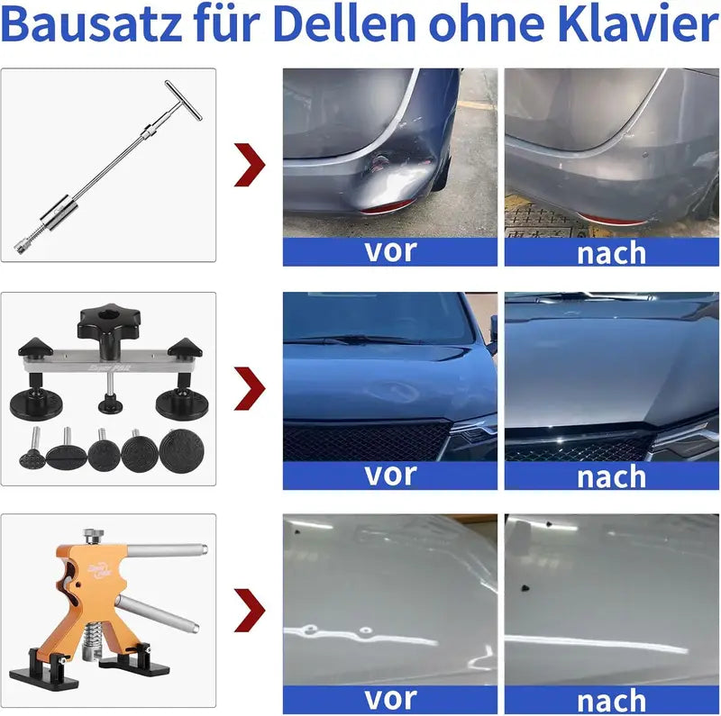 Car Dent Repair Kit - Paintless Body Ding & Dent Removal Tools with Suction Cups