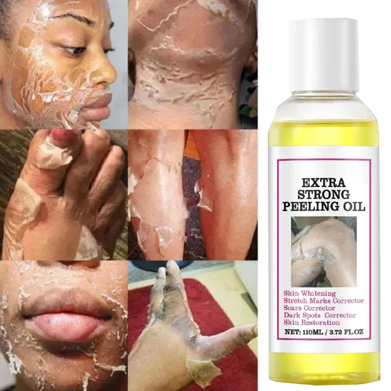 Organic Peeling Body Oil & Exfoliating Lotion for Dark Skin Brightening