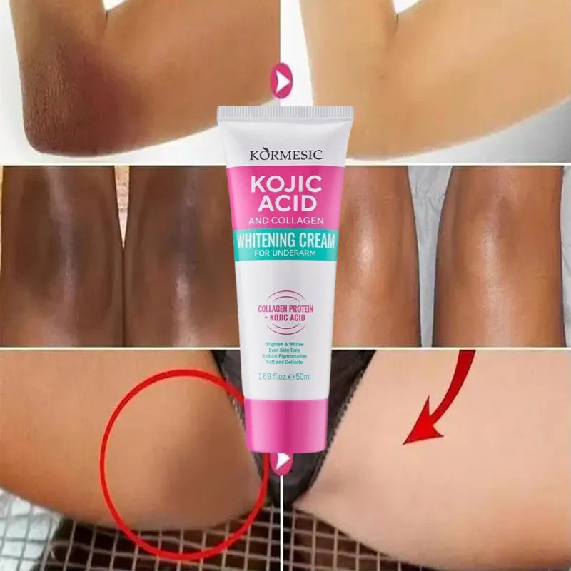 Whitening Cream for Private Parts & Body - Brighten Dark Areas & Remove Melanin