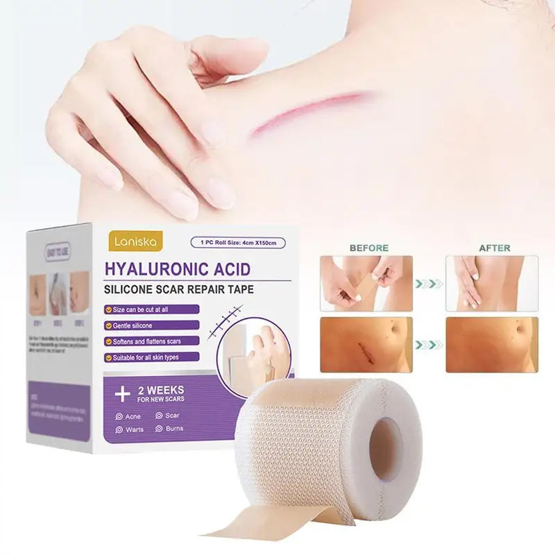 Silicone Self-Adhesive Scar Sheet Cover Patch Waterproof Breathable Skin Care Tape