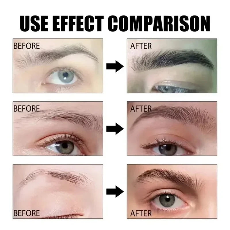 Eyebrow & Eyelash Growth Serum - Hair Loss Prevention & Fuller, Thicker Lengthening 30ml