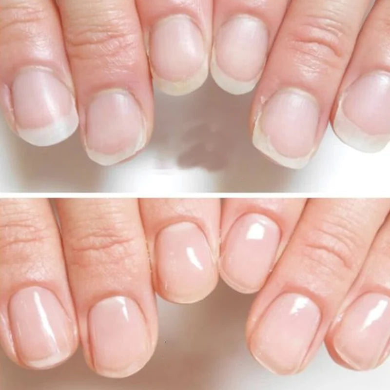 Nail Strengthening Treatment - 9 in 1 Nail Growth Complex for Brittle Nails