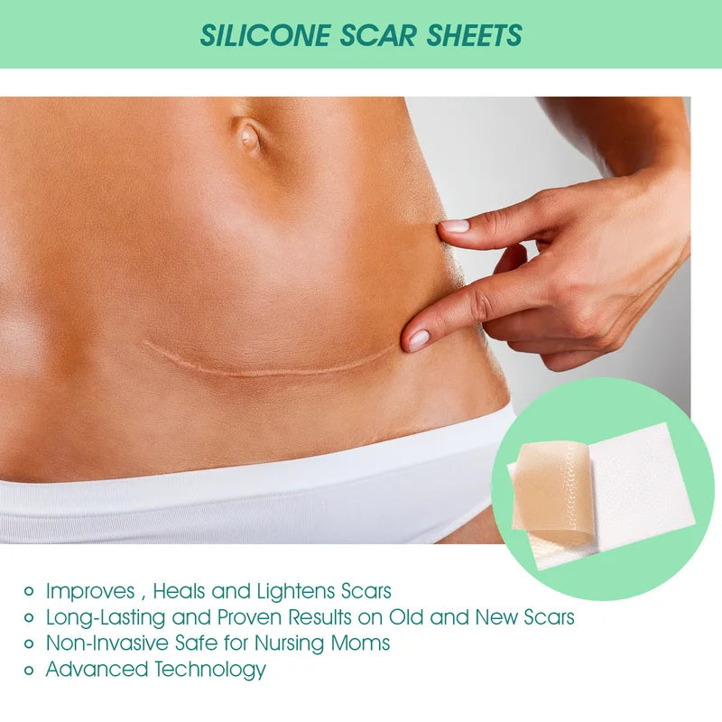Scar Patches Silicone Gel Sheet Correctors for Skin Repair Self-Adhesive Burn & Wound Cover