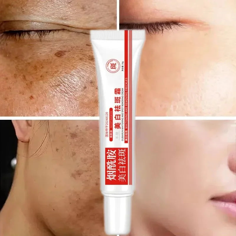 Freckle & Dark Spot Corrector Cream - Brightening Face Serum with Niacinamide, 30g