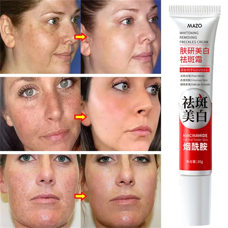 Powerful Skin Brightening Cream for Melasma Dark Spots & Pigmentation Removal - Korean Skin Care