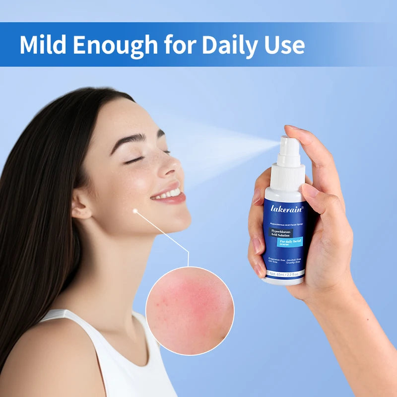 Hypochlorous Acid Facial Spray for Redness and Breakout Relief - 65ml