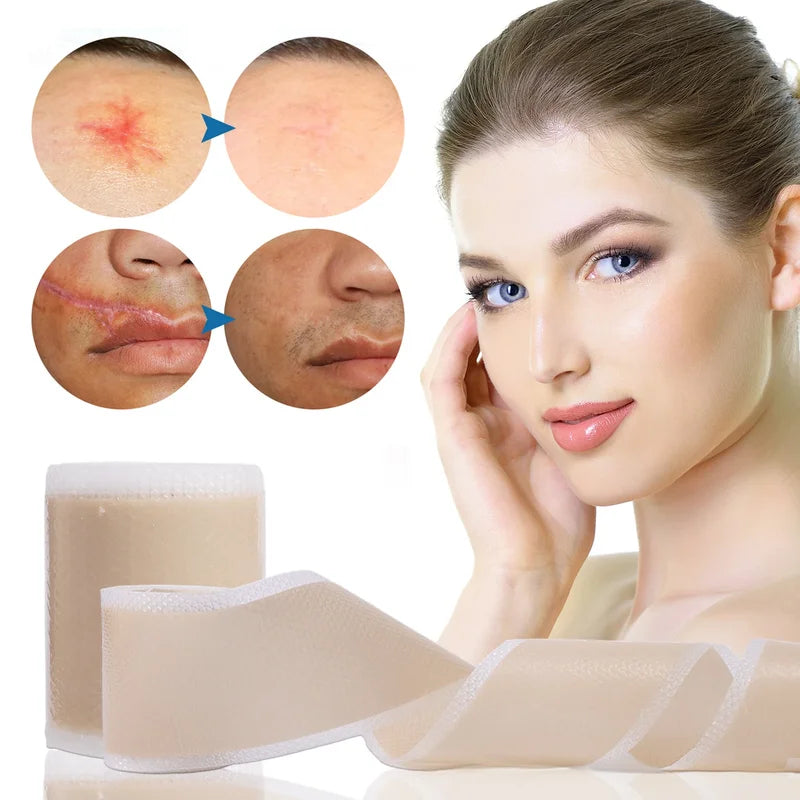 Silicone Self-Adhesive Scar Cover Patches Waterproof Skin Care Tape - Tattoo, Skin, Body