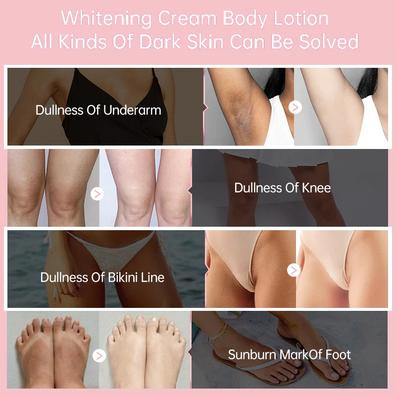 Body Whitening Cream for Dark Skin - Melanin Removal & Brightening Lotion