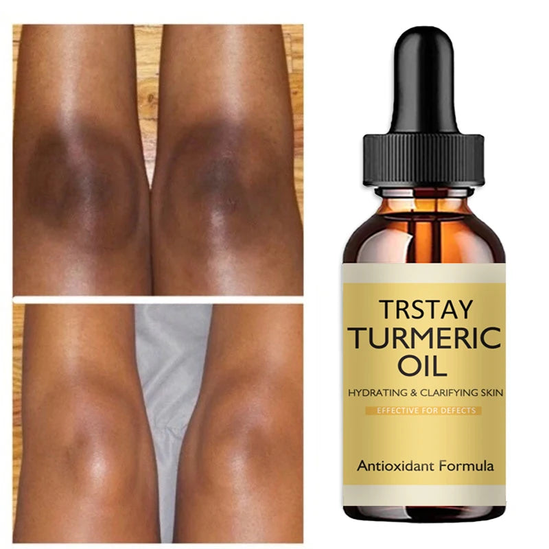 Turmeric Oil Brightening Serum for Face & Body - Dark Skin Glow Treatment