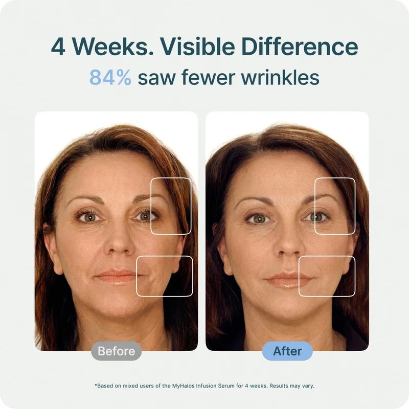 Complete Facial Care Kit with 2 Tools & 6 Essences for Hydrating & Anti-Aging