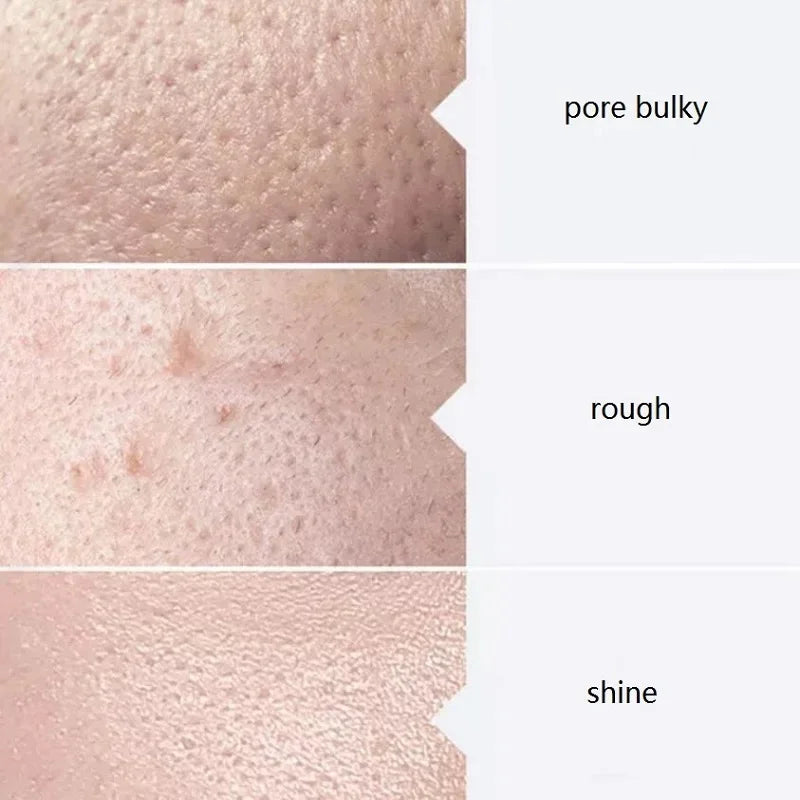 Facial Serum Kit for Skin Deep Cleaning & Hydration - 3x400ml
