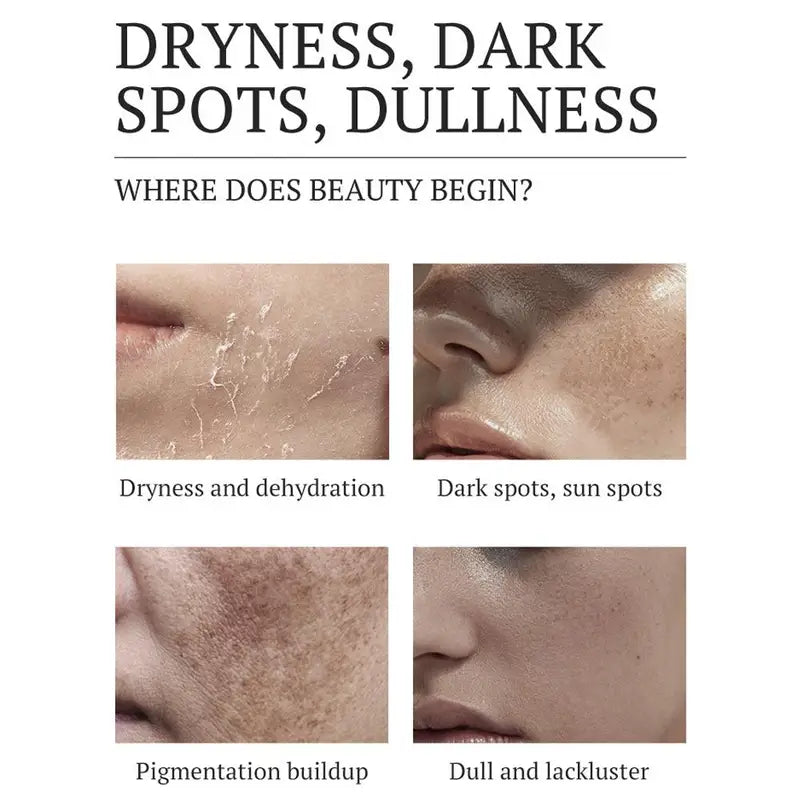 Dark Spots Removal Cream - Brightening Skin Pigmentation Corrector for Face