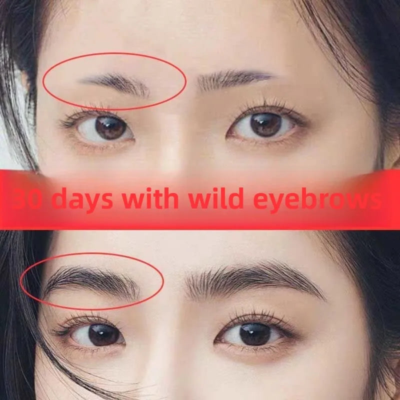 Eyebrow & Eyelash Growth Serum 30ml - Hair Loss Prevention & Thickening