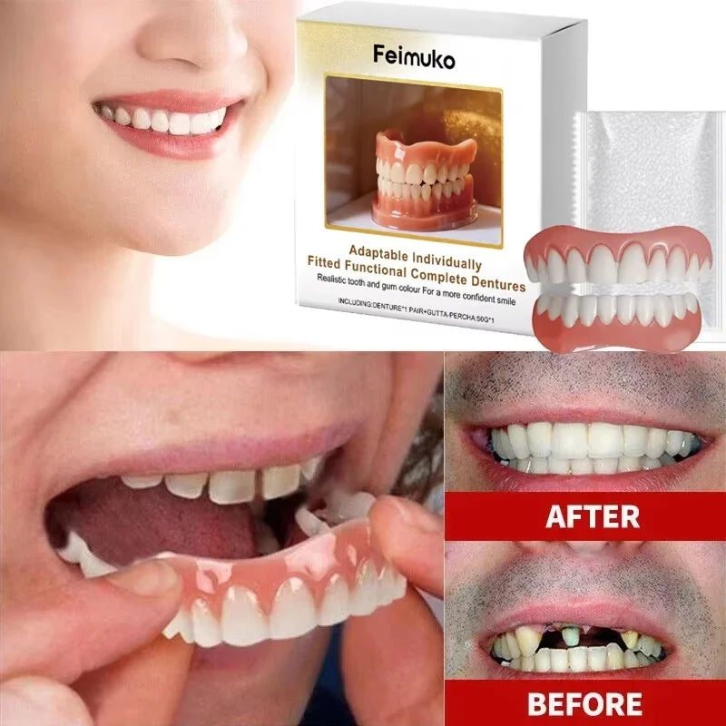 Denture Silicone Kit with Soft Liners for Upper and Lower False Teeth - Comfortable Reline Set