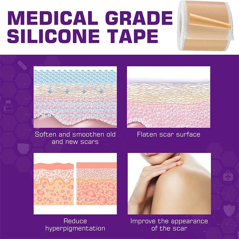 Reusable Silicone Scar Sheets for Keloid & Surgical Scars - Waterproof & Hypoallergenic