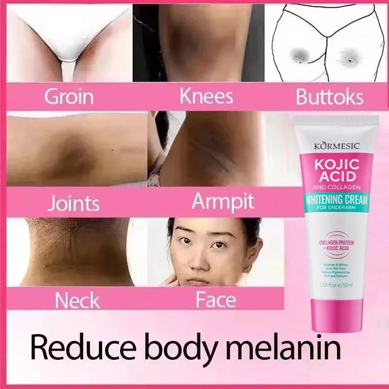 Whitening Cream for Private Parts & Body - Brighten Dark Areas & Remove Melanin