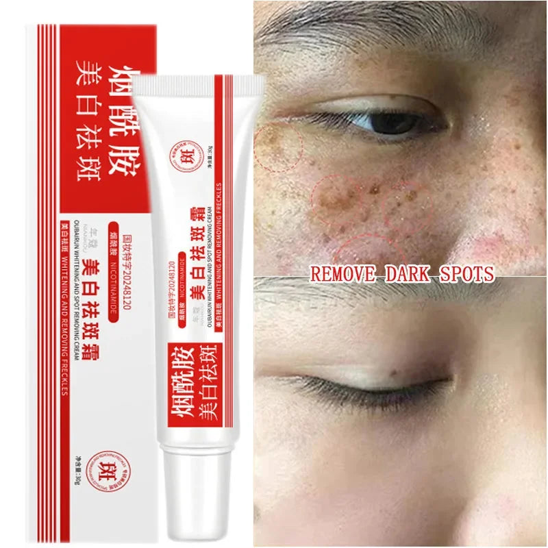 Freckle & Dark Spot Corrector Cream - Brightening Face Serum with Niacinamide, 30g