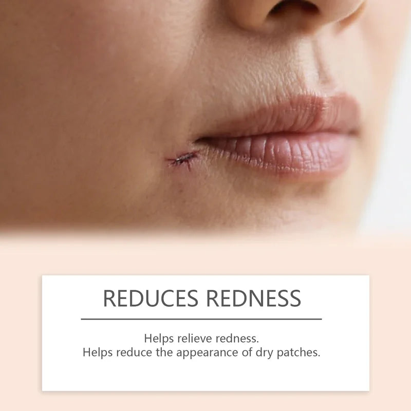 Silicone Scar Stick for Acne & Skin Repair - Redness & Blemish Support