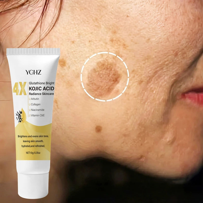 Kojic Acid Face Cream for Brightening Dark Spots & Even Skin Tone - Moisturizing, Non-Greasy, Day & Night Use