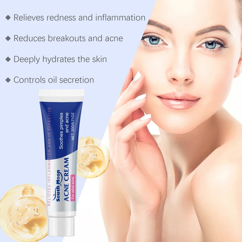Anti Acne Cream Oil Control Pimple Spot Treatment for All Skin Types - 20g