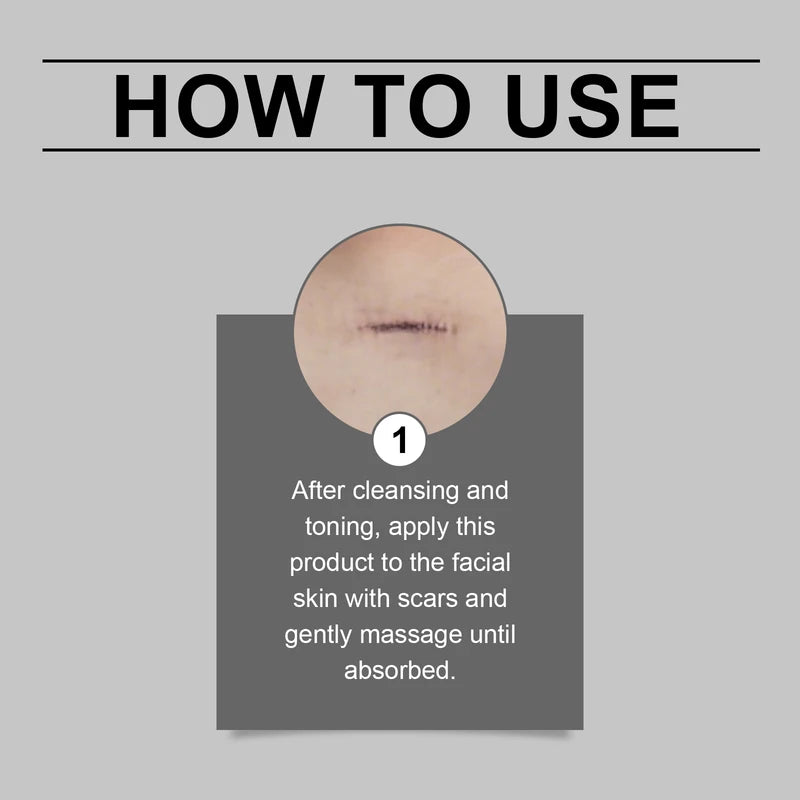 Portable Silicone Scar Stick for Face & Body Skin Repair, Reduce Allergies